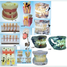 Equipo de Educación Científica Oral Modelo de Relleno de Canal de Raíz Modelo de Dientes Dentales